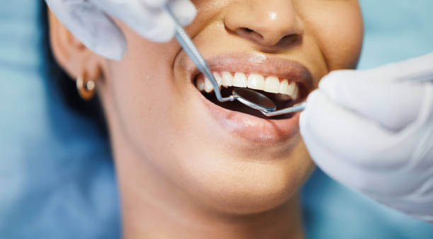 Best Emergency Cosmetic Dentistry in Beckley, WV