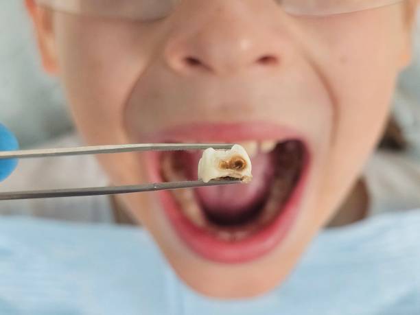 Best Urgent Dental Care for Toothache in Beckley, WV