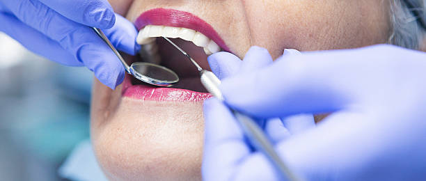 Best Emergency Root Canal Treatment in Beckley, WV